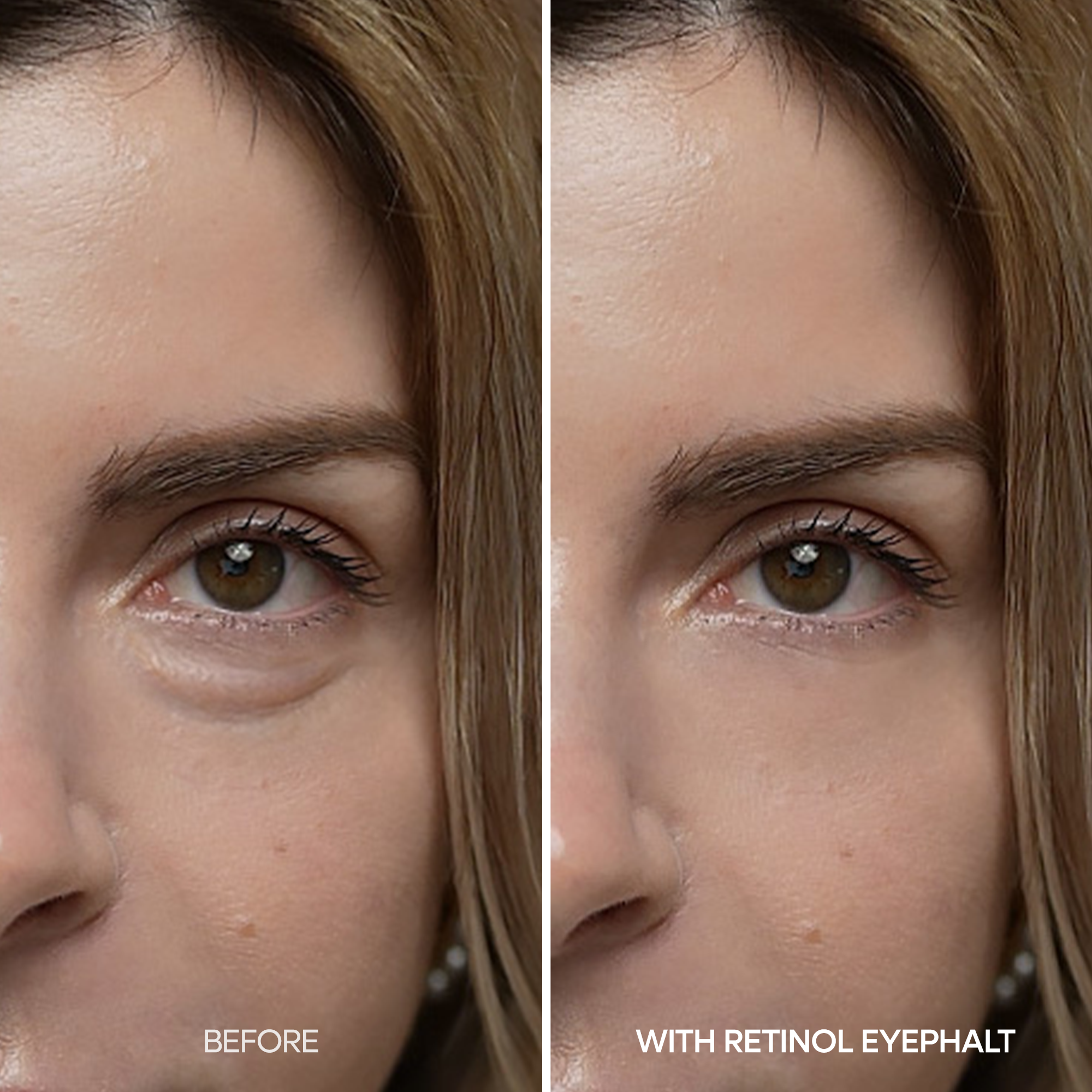 [FLASH 1+1 DEAL] Retinol Eyebag Cream