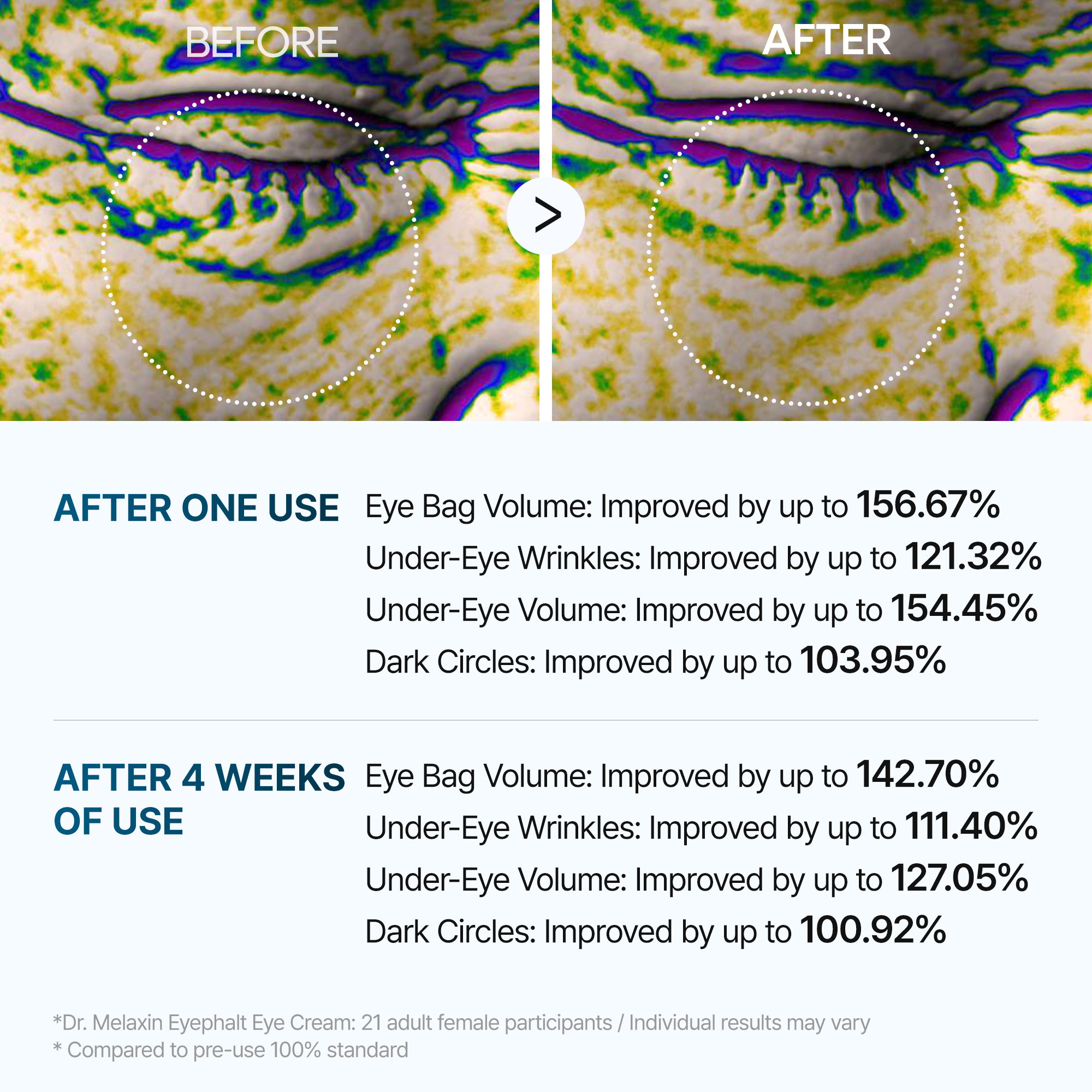 [SPECIAL 1+1 DEAL] Eyephalt eyebag cream